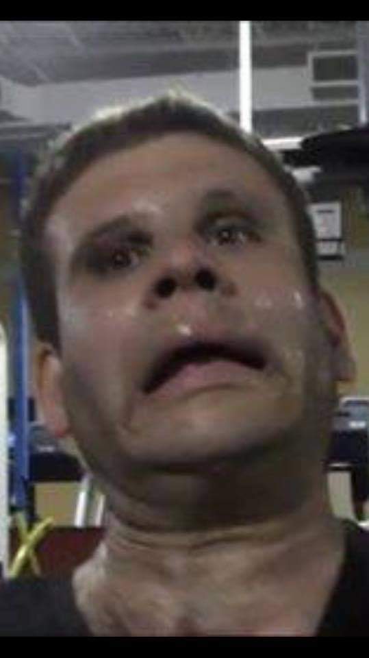 jason spastic
