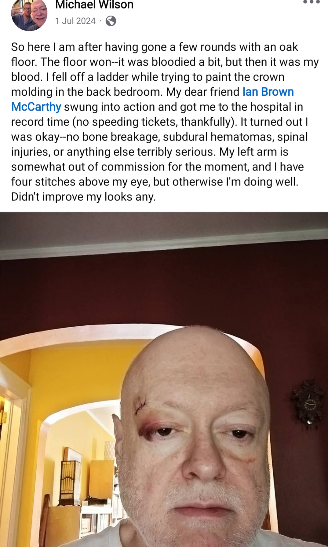 fell off, def not punched in the head