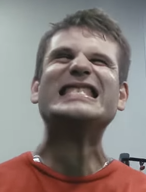 jason teeth1