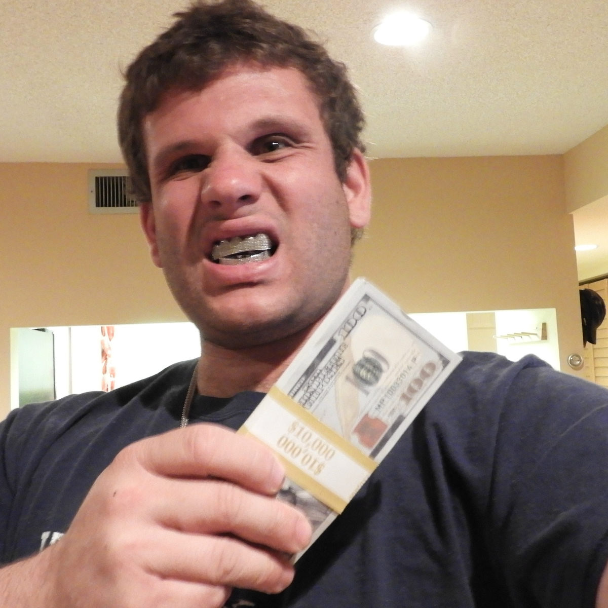 jason fake teeth